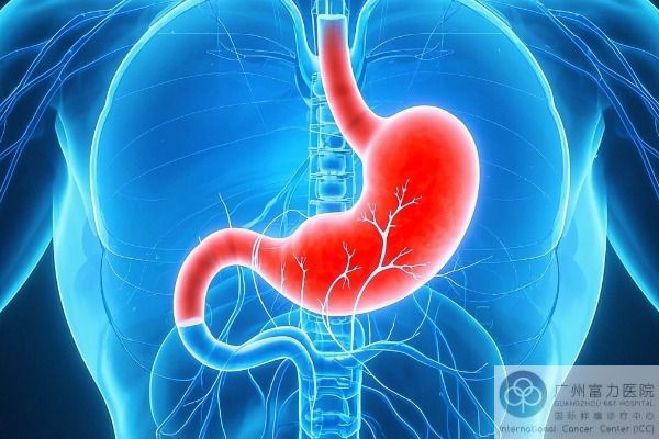 胃癌.jpg
