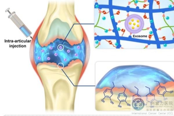 干细胞修复骨关节 (5).jpg