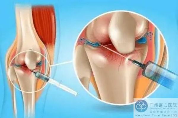 干细胞修复骨关节 (4).jpg